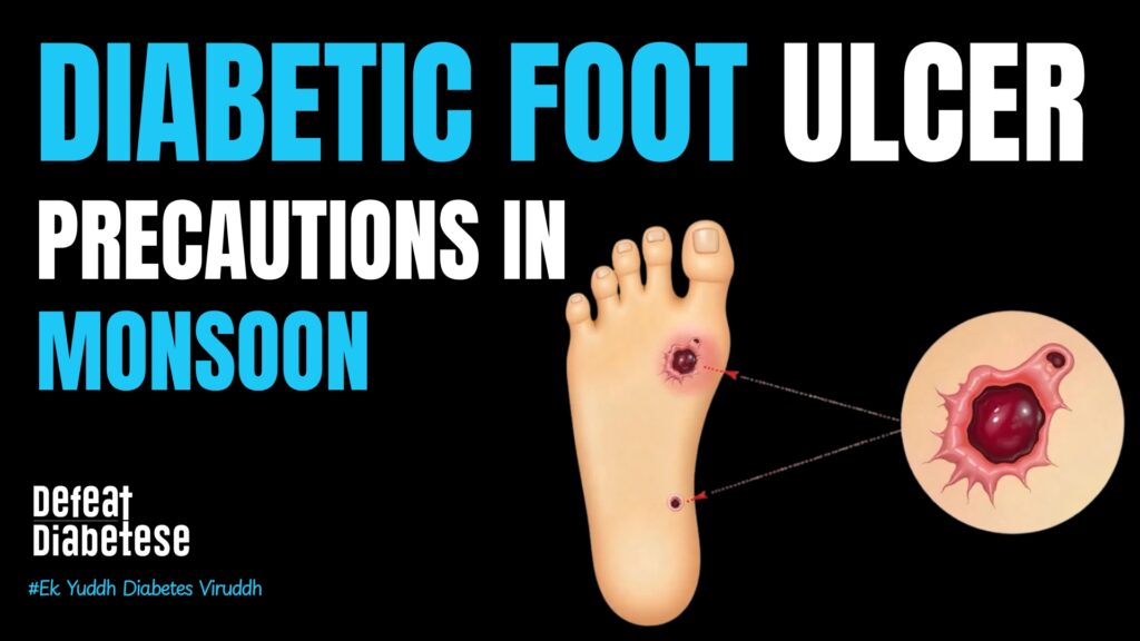 Diabetic foot ulcer precautions monsoon foot care and peripheral neuropathy protection explained by Dr. Prakash Kurmi